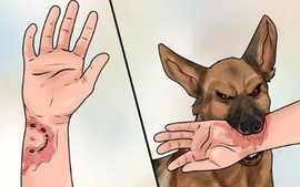 Cách tốt nhất phòng tránh bệnh dại