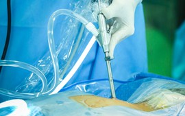 Bệnh lý cột sống: Bước tiến khoa học từ các kỹ thuật ít xâm lấn thế hệ mới