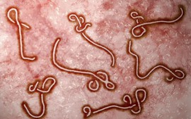 WHO báo động khẩn về Ebola ở châu Phi, Việt Nam tăng giám sát cửa khẩu