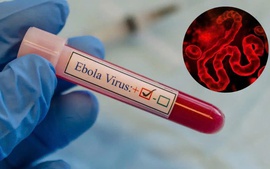 Virus Ebola có xu hướng lan rộng và biện pháp phòng ngừa của các nước