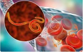 Dịch bệnh Ebola tiếp tục diễn biến phức tạp