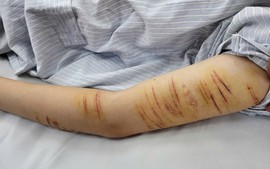 Trẻ vị thành niên và hành vi tự gây thương tích: Đừng để mạng xã hội thay thế kết nối gia đình