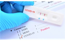 Health ministry confirms 1,594 new COVID-19 cases