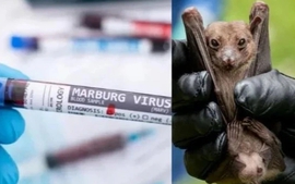 Health ministry calls for strict surveillance on Marburg virus disease