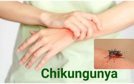 Health ministry: Chikungunya not yet detected in Viet Nam