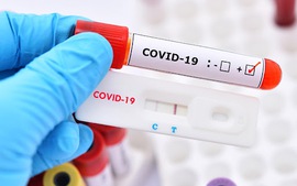 Bộ Y tế: Các DN khẩn trương báo cáo giá bán test xét nghiệm COVID-19