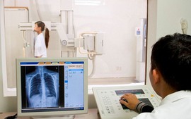 Vướng mắc trong quy định nhân lực sử dụng máy X-quang?