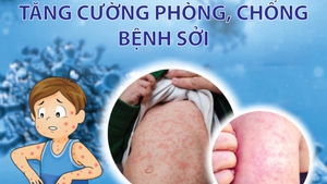 Infographics: Tăng cường công tác phòng, chống bệnh Sởi