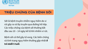 WHO khuyến cáo bảo đảm miễn dịch đối với bệnh sởi trong dịp Tết