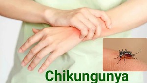 Health ministry: Chikungunya not yet detected in Viet Nam