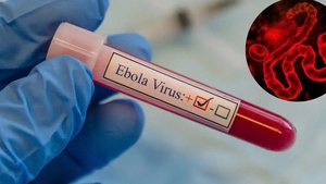 Health ministry urges localities to strengthen Ebola surveillance and preparedness