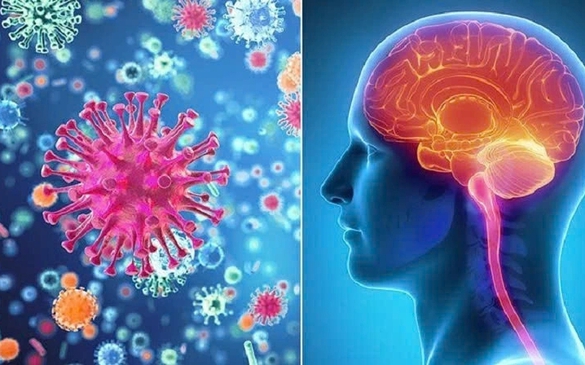 Cảnh báo các ca bệnh não mô cầu xâm lấn: Bệnh không phổ biến nhưng rất nguy hiểm