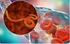 Dịch bệnh Ebola tiếp tục diễn biến phức tạp